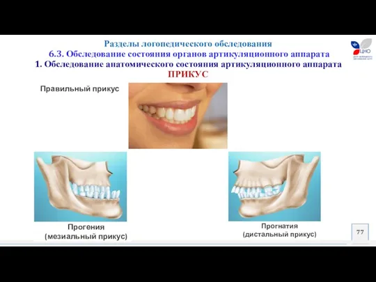 Разделы логопедического обследования 6.3. Обследование состояния органов артикуляционного аппарата 1.