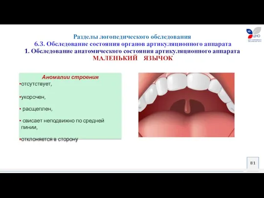 Разделы логопедического обследования 6.3. Обследование состояния органов артикуляционного аппарата 1.