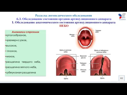 Разделы логопедического обследования 6.3. Обследование состояния органов артикуляционного аппарата 1.