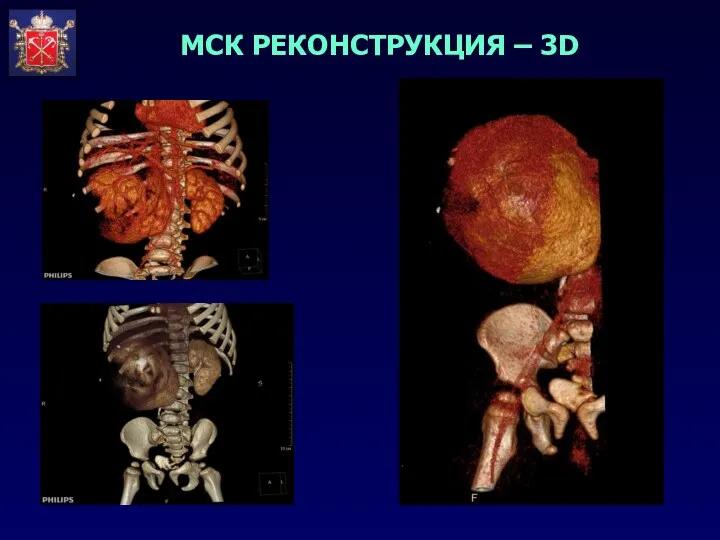 МСК РЕКОНСТРУКЦИЯ – 3D