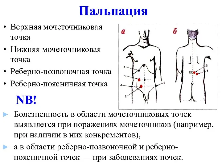 Пальпация Верхняя мочеточниковая точка Нижняя мочеточниковая точка Реберно-позвоночная точка Реберно-поясничная