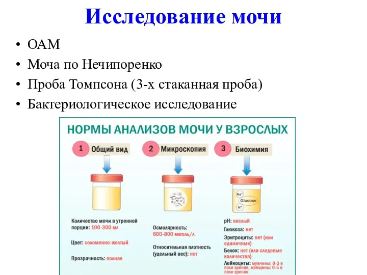 Исследование мочи ОАМ Моча по Нечипоренко Проба Томпсона (3-х стаканная проба) Бактериологическое исследование