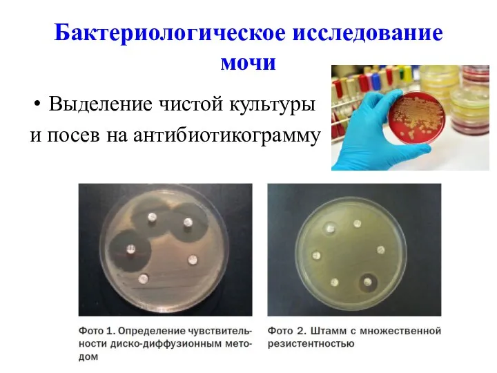 Бактериологическое исследование мочи Выделение чистой культуры и посев на антибиотикограмму