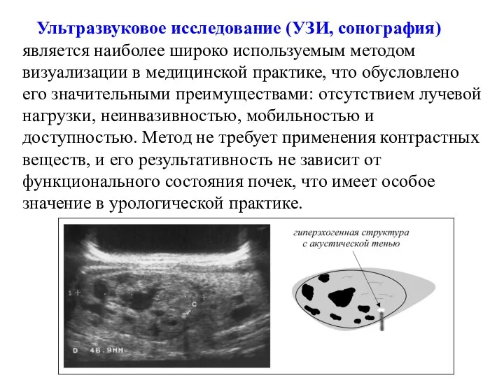 Ультразвуковое исследование (УЗИ, сонография) является наиболее широко используемым методом визуализации