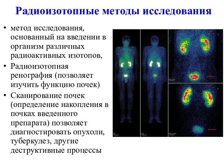 Радиоизотопные методы исследования метод исследования, основанный на введении в организм