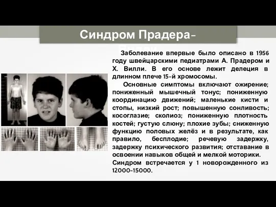 Синдром Прадера-Вилли Заболевание впервые было описано в 1956 году швейцарскими