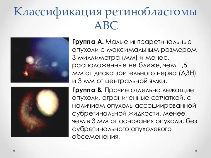 Классификация ретинобластомы АВС Группа А. Малые интраретинальные опухоли с максимальным