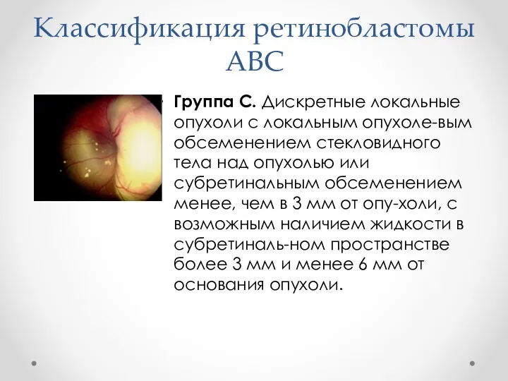 Классификация ретинобластомы АВС Группа C. Дискретные локальные опухоли с локальным