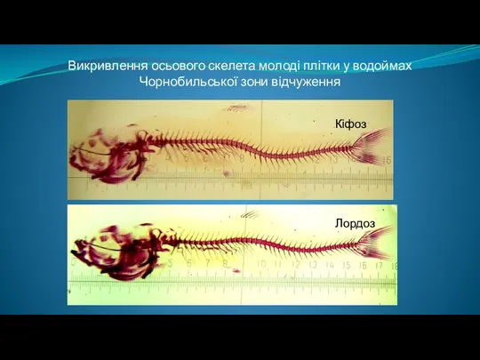Викривлення осьового скелета молоді плітки у водоймах Чорнобильської зони відчуження Лордоз Кіфоз