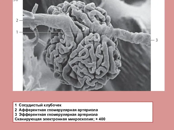 1 Сосудистый клубочек 2 Афферентная гломерулярная артериола 3 Эфферентная гломерулярная артериола Сканирующая электронная микроскопия; × 400