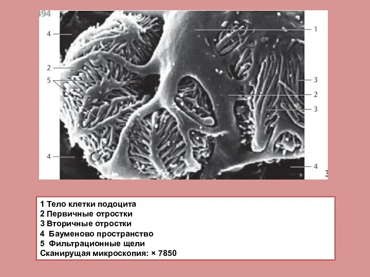 1 Тело клетки подоцита 2 Первичные отростки 3 Вторичные отростки