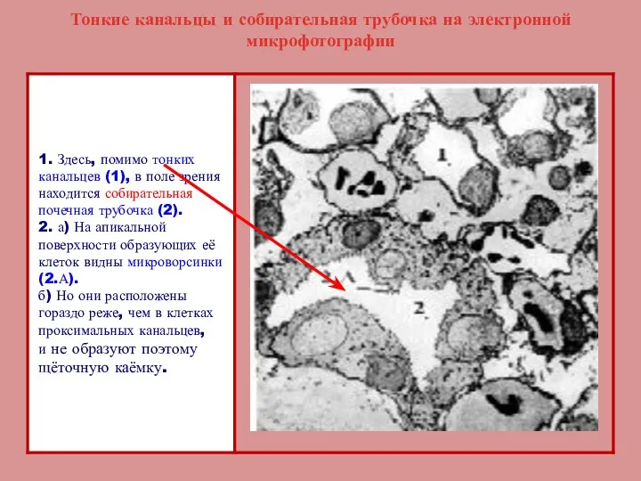 Тонкие канальцы и собирательная трубочка на электронной микрофотографии