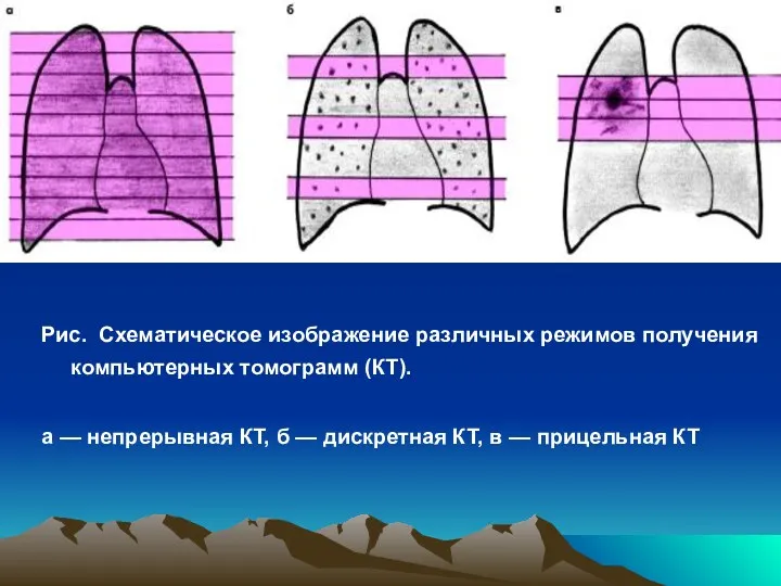 Рис. Схематическое изображение различных режимов получения компьютерных томограмм (КТ). а