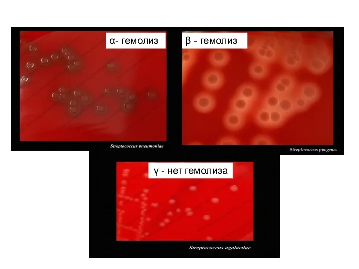 α- гемолиз β - гемолиз γ - нет гемолиза