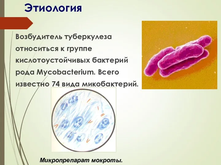 Этиология Возбудитель туберкулеза относиться к группе кислотоустойчивых бактерий рода Mycobacterium. Всего известно 74