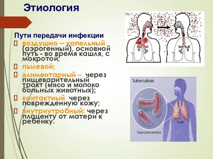 Этиология Пути передачи инфекции воздушно – капельный (аэрогенный), основной путь