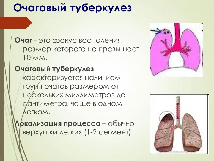 Очаговый туберкулез Очаг - это фокус воспаления, размер которого не превышает 10 мм.