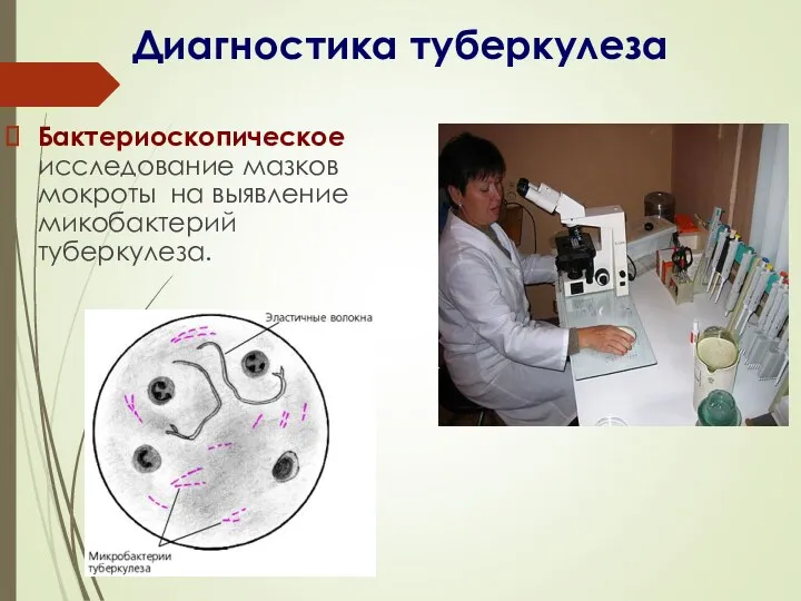 Бактериоскопическое исследование мазков мокроты на выявление микобактерий туберкулеза. Диагностика туберкулеза