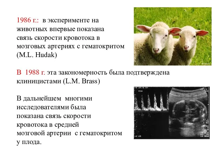 1986 г.: в эксперименте на животных впервые показана связь скорости кровотока в мозговых