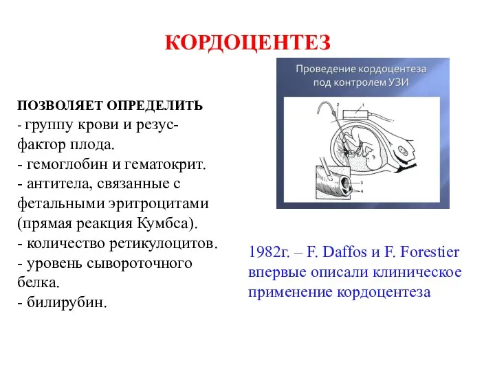 КОРДОЦЕНТЕЗ ПОЗВОЛЯЕТ ОПРЕДЕЛИТЬ - группу крови и резус-фактор плода. -