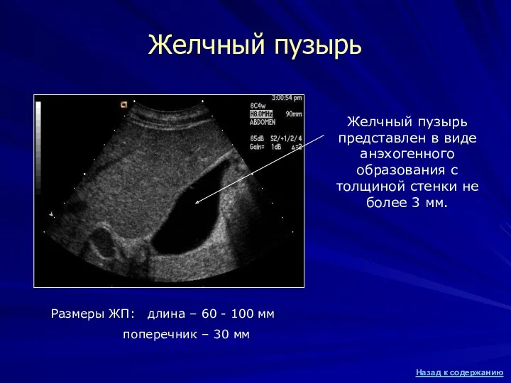 Желчный пузырь Желчный пузырь представлен в виде анэхогенного образования с