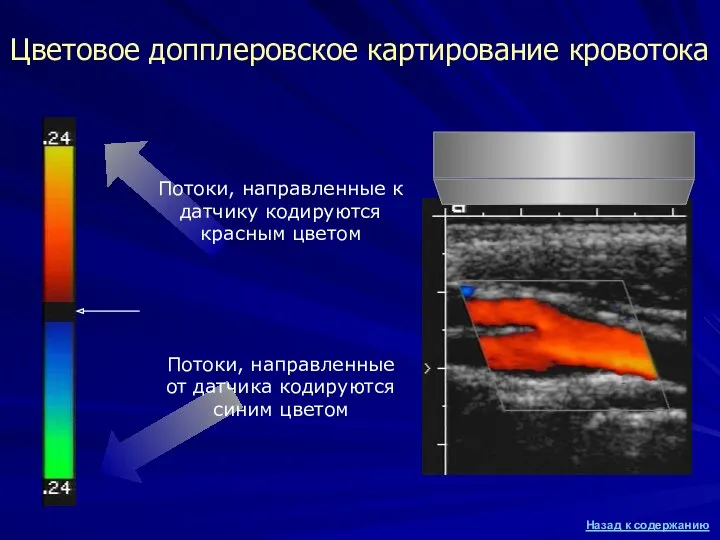 Цветовое допплеровское картирование кровотока