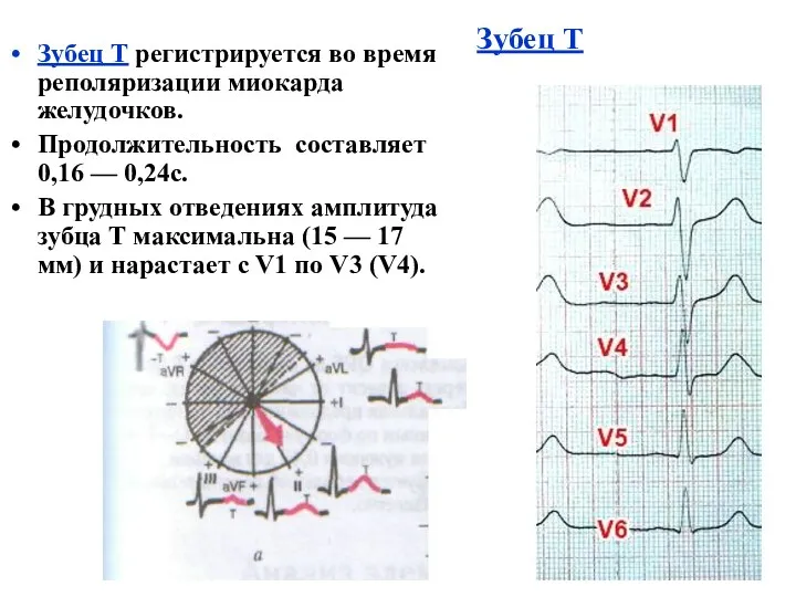 Зубец Т Зубец Т регистрируется во время реполяризации миокарда желудочков.