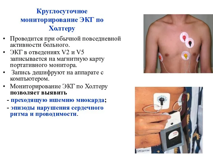 Круглосуточное мониторирование ЭКГ по Холтеру Проводится при обычной повседневной активности