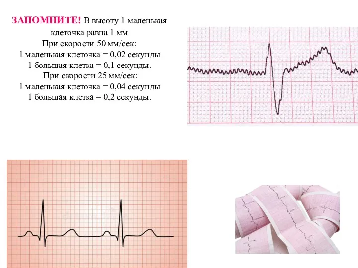 ЗАПОМНИТЕ! В высоту 1 маленькая клеточка равна 1 мм При