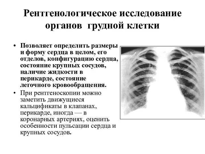 Рентгенологическое исследование органов грудной клетки Позволяет определить размеры и форму