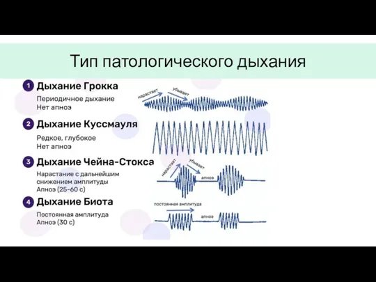 Тип патологического дыхания