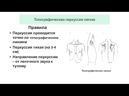 Топографическая перкуссия легких Правила Перкуссия проводится точно по топографическим линиям