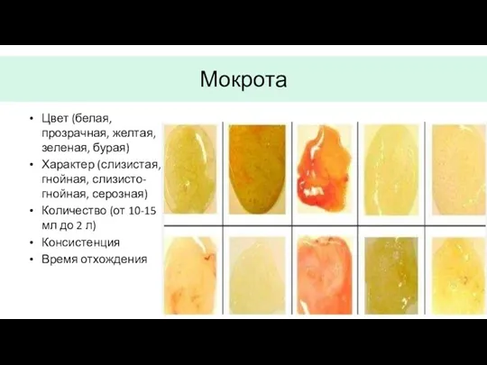 Мокрота Цвет (белая, прозрачная, желтая, зеленая, бурая) Характер (слизистая, гнойная,