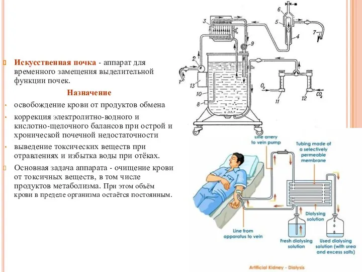 Искусственная почка - аппарат для временного замещения выделительной функции почек.