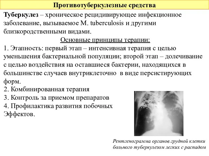 Противотуберкулезные средства Туберкулез – хроническое рецидивирующее инфекционное заболевание, вызываемое M.
