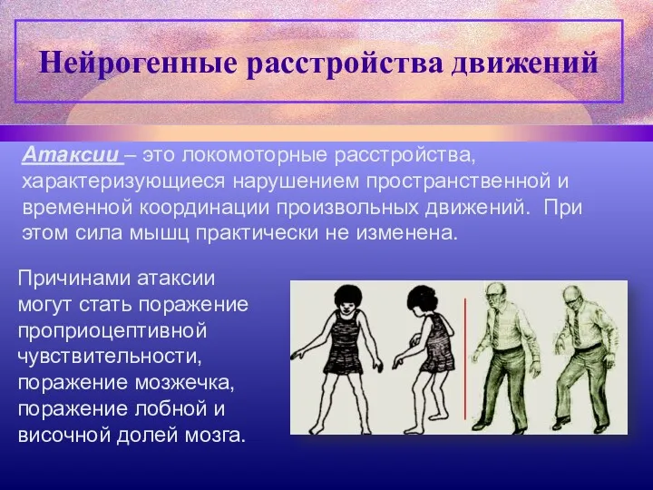 Нейрогенные расстройства движений Атаксии – это локомоторные расстройства, характеризующиеся нарушением