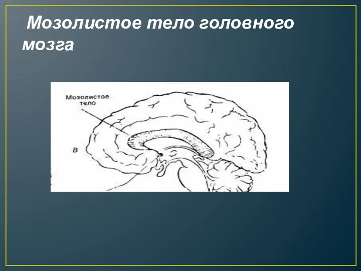Мозолистое тело головного мозга