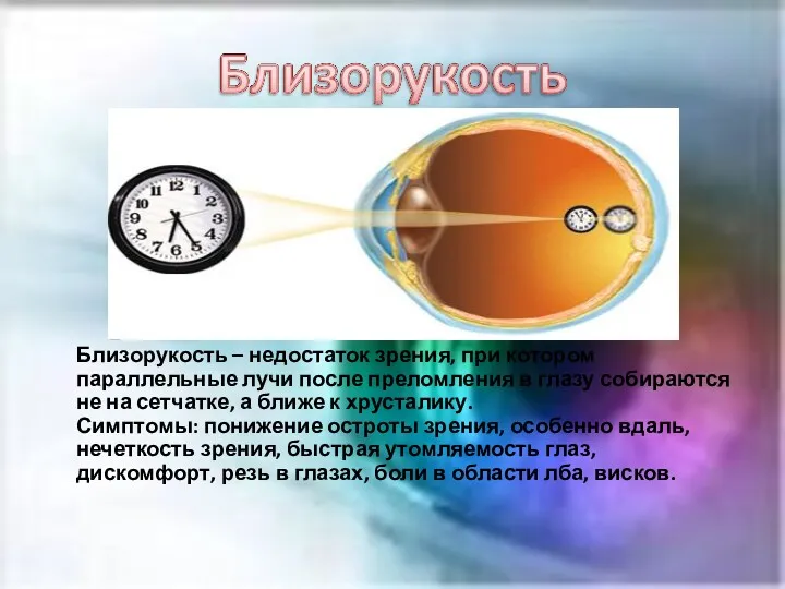 Близорукость – недостаток зрения, при котором параллельные лучи после преломления