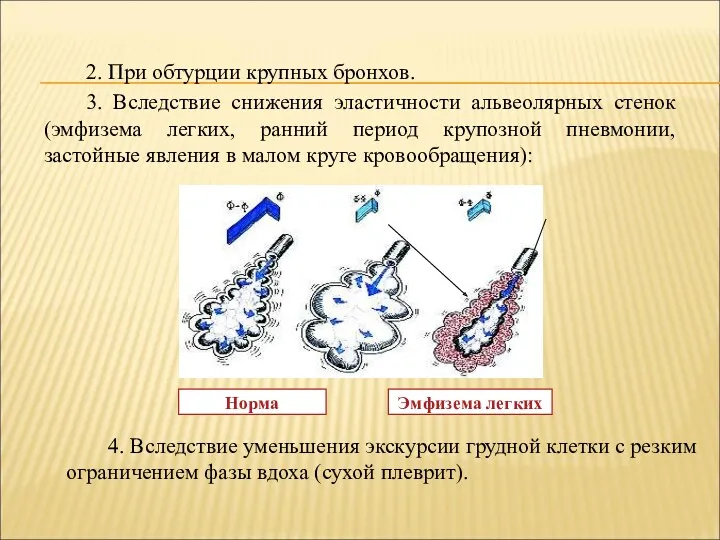 2. При обтурции крупных бронхов. 3. Вследствие снижения эластичности альвеолярных