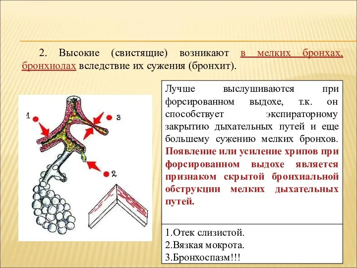 2. Высокие (свистящие) возникают в мелких бронхах, бронхиолах вследствие их