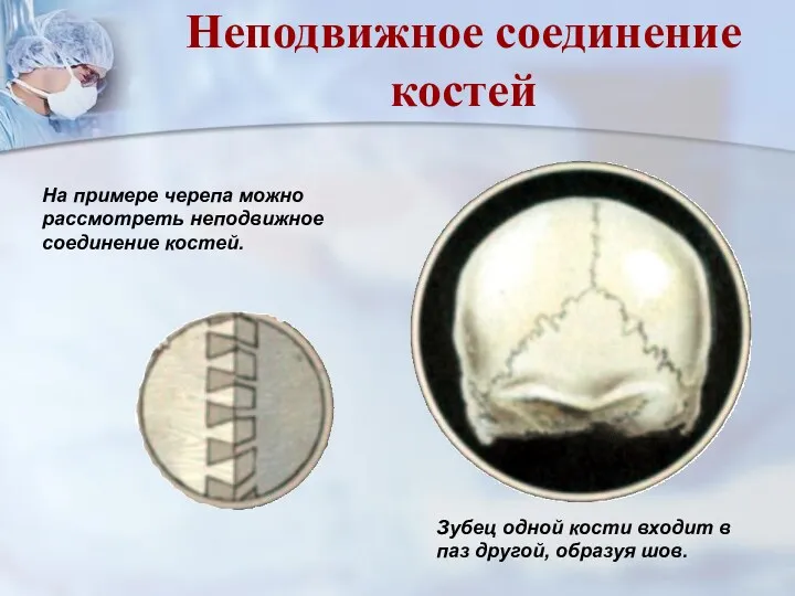 На примере черепа можно рассмотреть неподвижное соединение костей. Зубец одной
