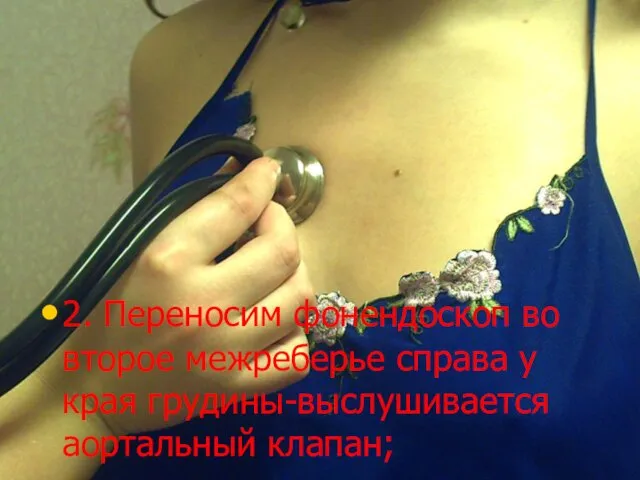 2. Переносим фонендоскоп во второе межреберье справа у края грудины-выслушивается аортальный клапан;