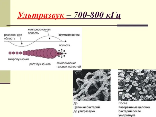 Ультразвук – 700-800 кГц