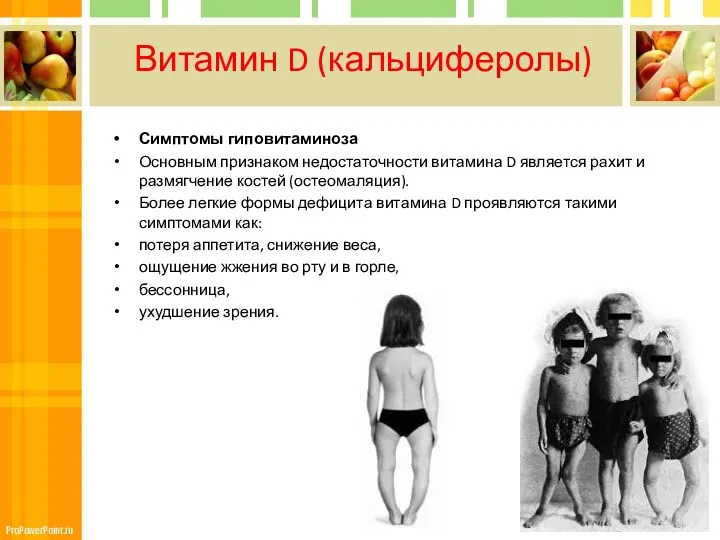 Витамин D (кальциферолы) Симптомы гиповитаминоза Основным признаком недостаточности витамина D