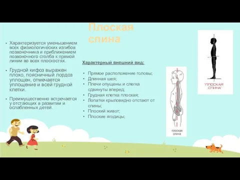 Плоская спина Характеризуется уменьшением всех физиологических изгибов позвоночника и приближением