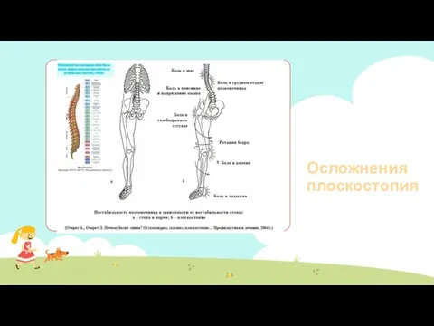 Осложнения плоскостопия