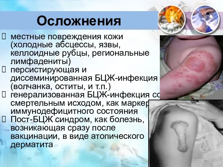 Осложнения местные повреждения кожи (холодные абсцессы, язвы, келлоидные рубцы, региональные