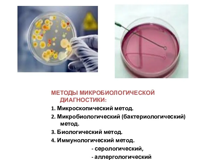 МЕТОДЫ МИКРОБИОЛОГИЧЕСКОЙ ДИАГНОСТИКИ: 1. Микроскопический метод. 2. Микробиологический (бактериологический) метод.