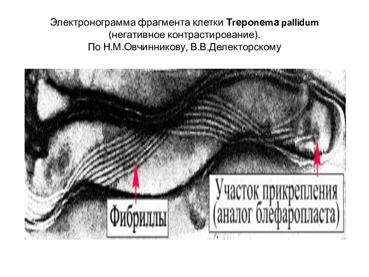 Электронограмма фрагмента клетки Тrероnеmа pallidum (негативное контрастирование). По Н.М.Овчинникову, В.В.Делекторскому