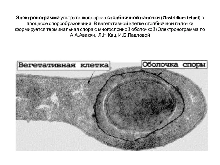 Электронограмма ультратонкого среза столбнячной палочки (Clostridium tetani) в процессе спорообразования.